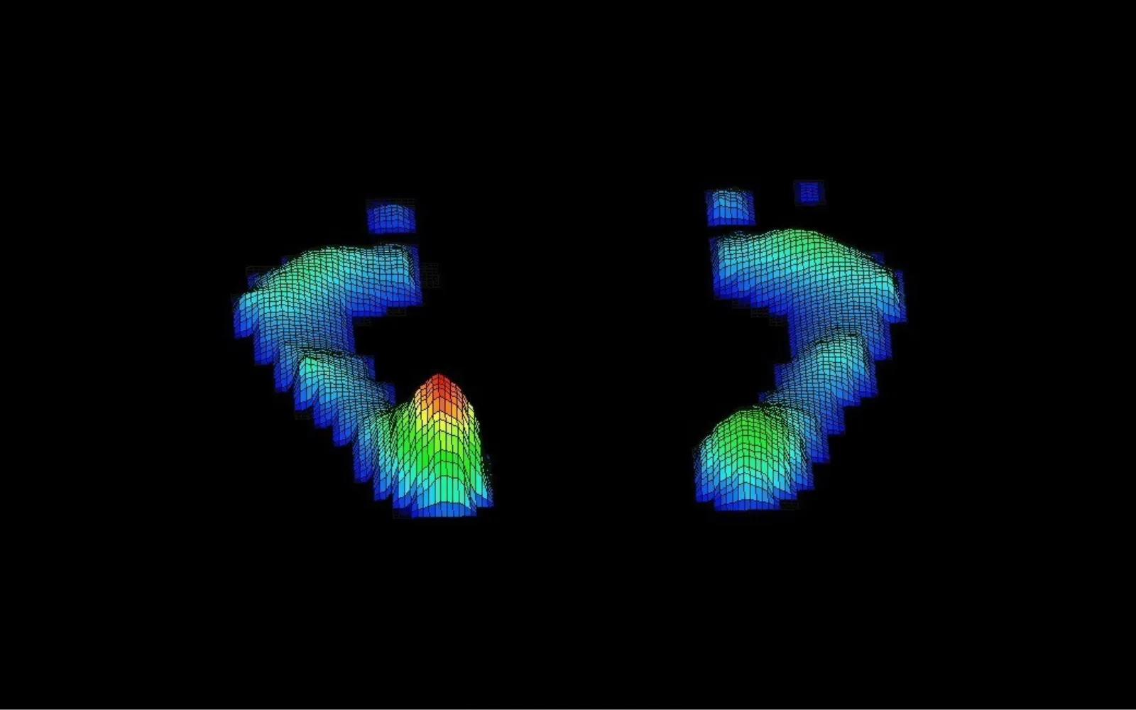 Podobarografia 3D przedstawiająca rozkład nacisków pod stopami