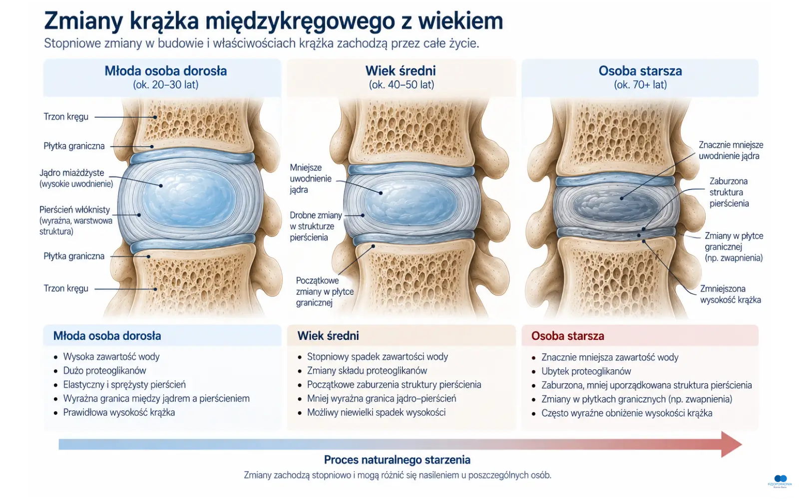 Zmiany krążka międzykręgowego z wiekiem – stopniowe zmniejszenie uwodnienia i zmiany struktury krążka