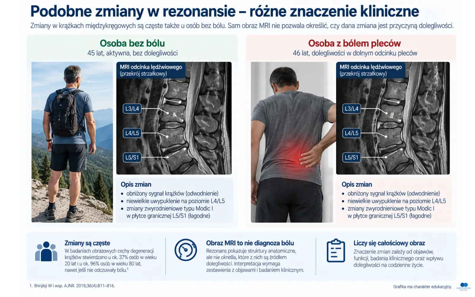 Zmiany krążka międzykręgowego w rezonansie MRI a ból – podobne zmiany mogą występować u osób z bólem i bez bólu